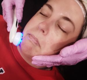 LED light therapy